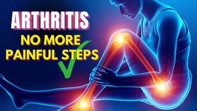 Natural Remedies For Arthritis