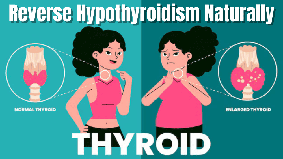 Hypothyroidism